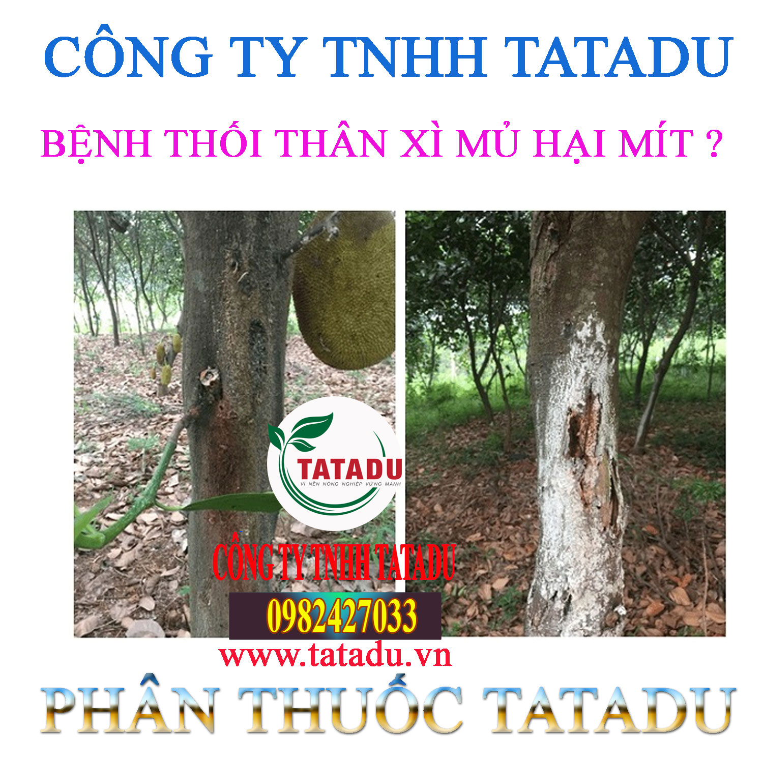 BENH THOI THAN XI MU HAI MIT