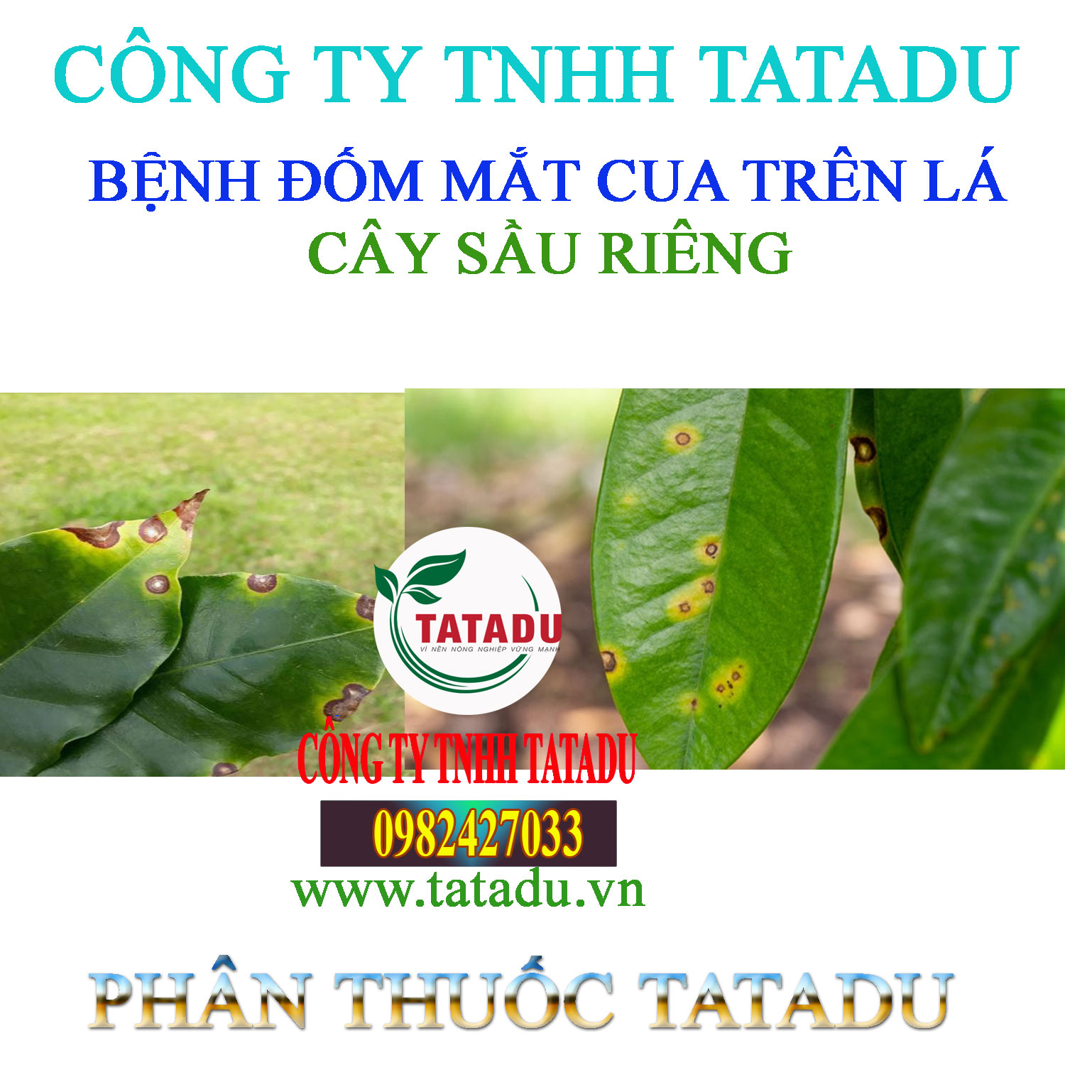 BENH DOM MAT CUA TREN LA SR
