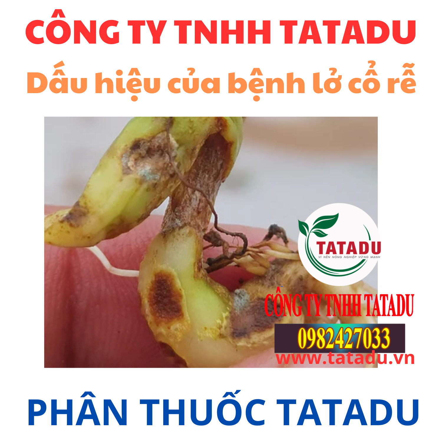 Dau hieu cua benh lo co re