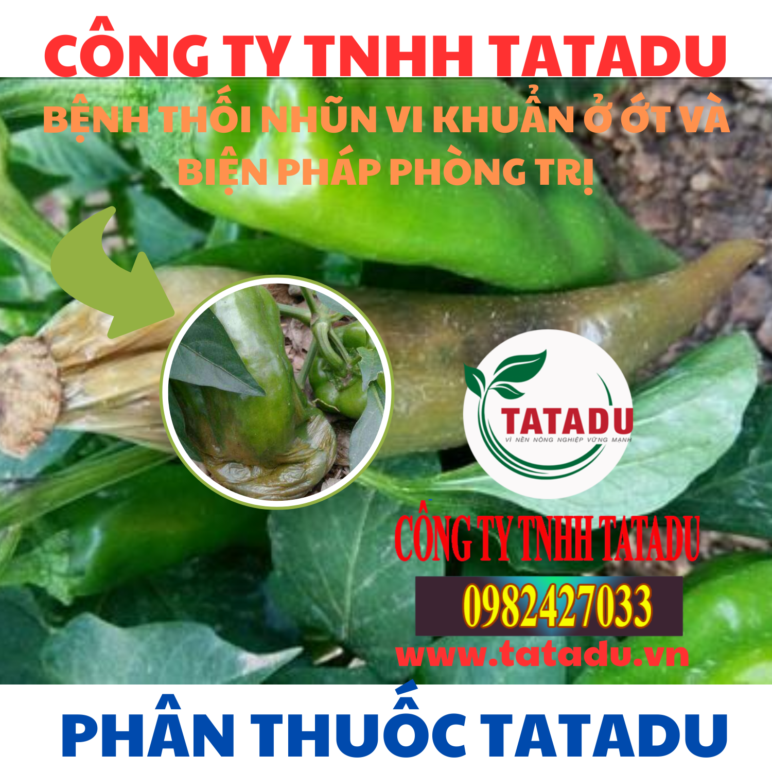 BENH THOI NHUN VI KHUAN O OT VA BIEN PHAP PHONG TRI