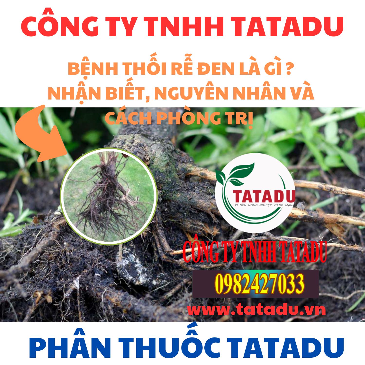 BENH THOI RE DEN LA GI NHAN BIET NGUYEN NHAN VA CACH PHONG TRI