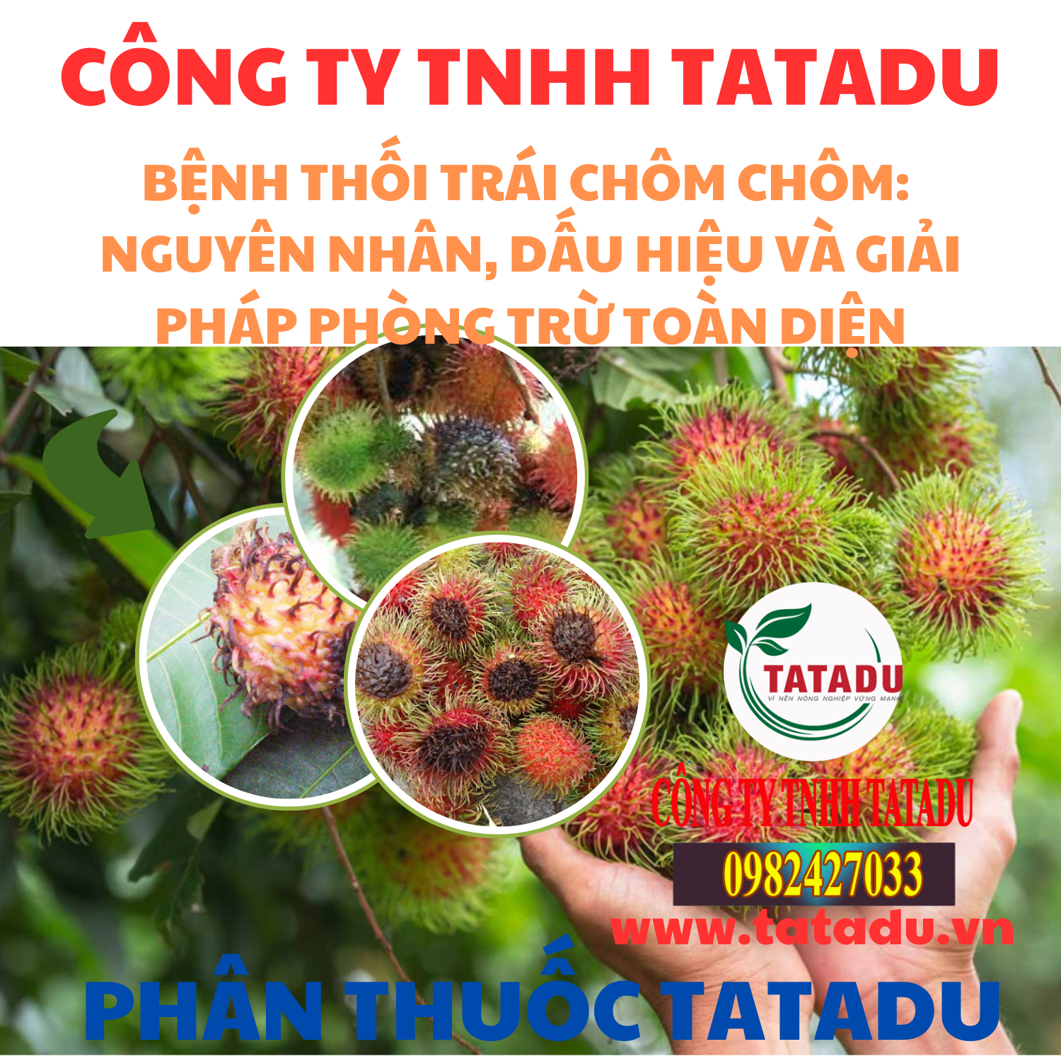 BENH THOI TRAI CHOM CHOM NGUYEN NHAN DAU HIEU VA GIAI PHAP PHONG TRU TOAN DIEN